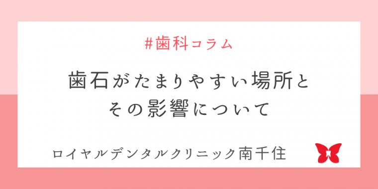 歯石がたまりやすい場所とその影響について